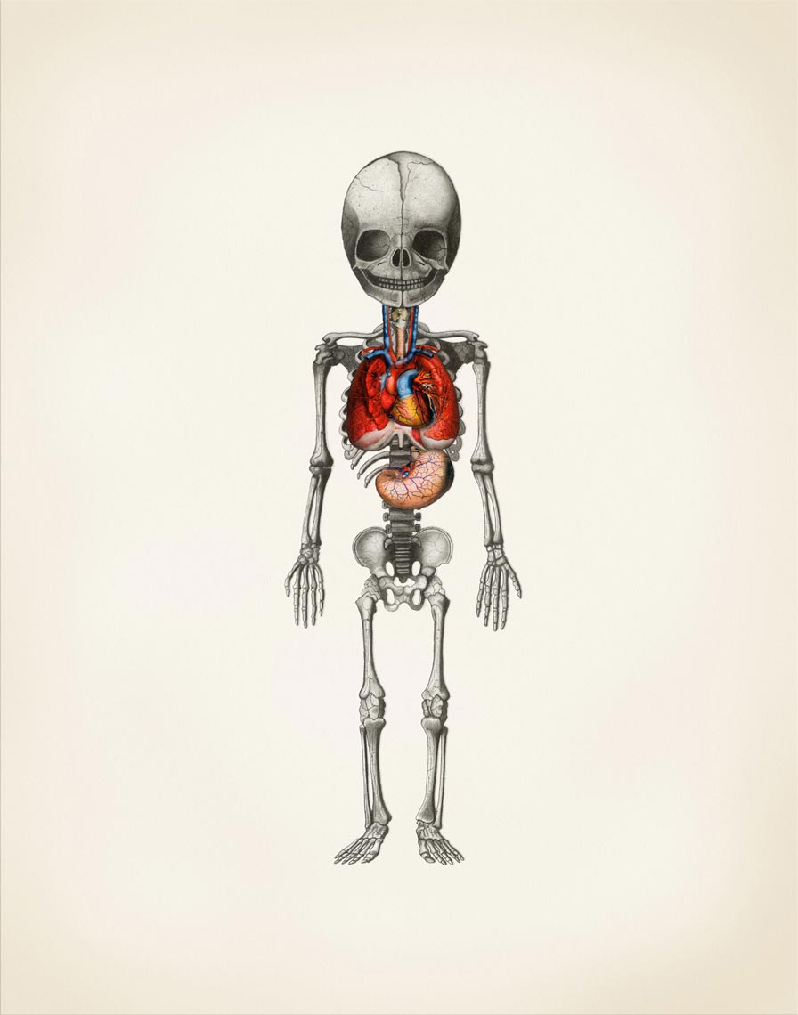 Diagnosis No. 1 - Graphite and Acrylic on Paper - Monthly New York Times Column